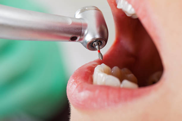 Best Urgent Dental Care for Toothache in Mountain Home Af, ID